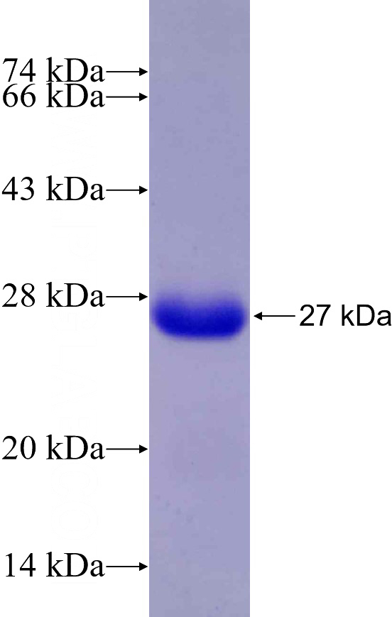 Recombinant Human ZNF217 SDS-PAGE