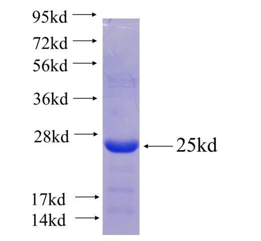 Recombinant human RAP1B(Full length) SDS-PAGE