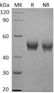 Human B4GALT3 (His tag) recombinant protein