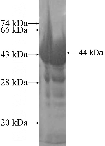 Recombinant Human VPS33A SDS-PAGE