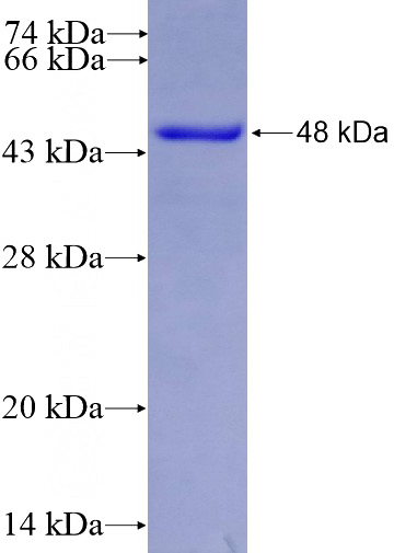 Recombinant Human RNF212 SDS-PAGE