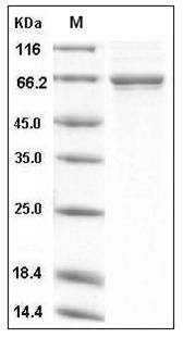 Human TGFBI / BIGH3 Protein (His Tag) SDS-PAGE