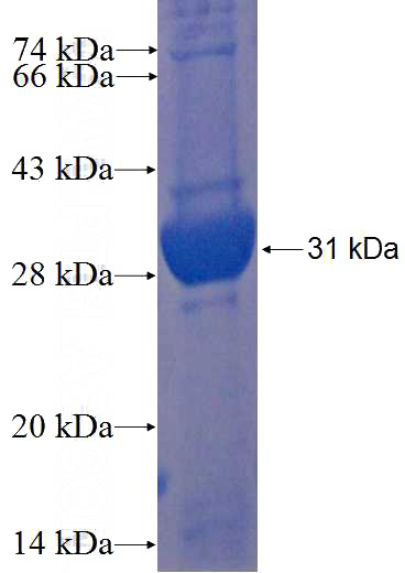 Recombinant Human SPSB3 SDS-PAGE