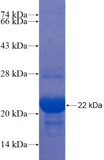 Recombinant Human KCTD16 SDS-PAGE