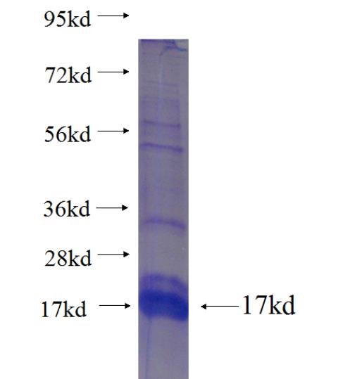Recombinant human ZNF540 SDS-PAGE