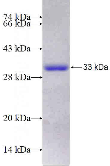 Recombinant Human RGS3 SDS-PAGE