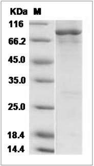 Human EGFR / HER1 / ErbB1 (aa 668-1210) Protein (His & GST Tag) SDS-PAGE