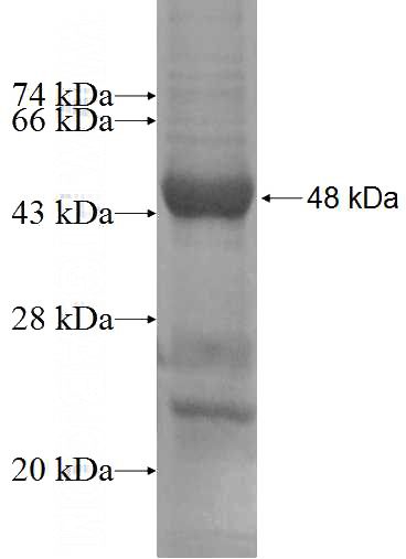 Recombinant Human SAR1A SDS-PAGE