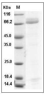 Human PGA4 / Pepsinogen A Protein (Fc Tag) SDS-PAGE