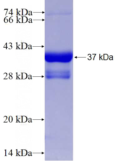 Recombinant Human PSMD14 SDS-PAGE
