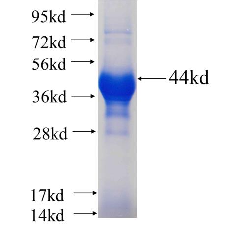 Recombinant human PGM2L1 SDS-PAGE