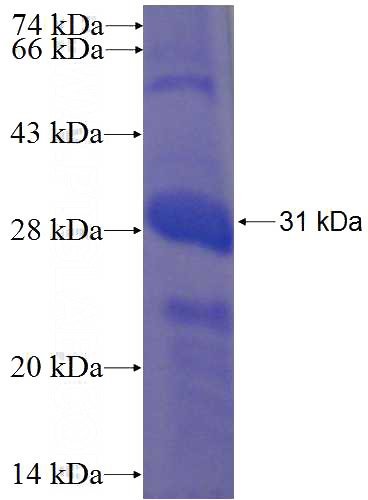 Recombinant Human LOC123688 SDS-PAGE