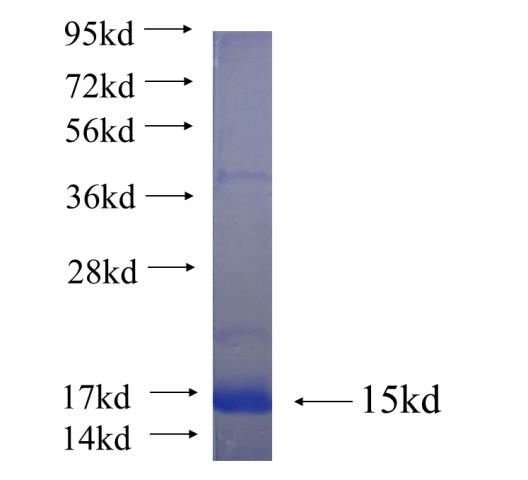 Recombinant human ASPM SDS-PAGE