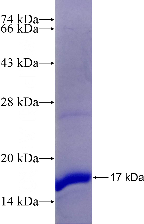 Recombinant Human SLC1A3 SDS-PAGE