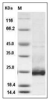 Mouse Podoplanin / PDPN Protein (His Tag) SDS-PAGE