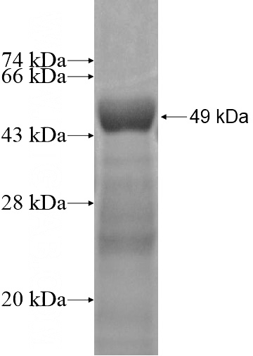 Recombinant Human CRYBB2 SDS-PAGE