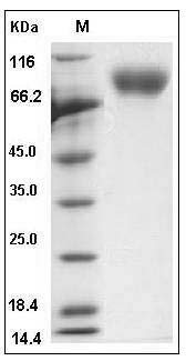 Human MAG / GMA / Siglec-4 Protein (His Tag) SDS-PAGE