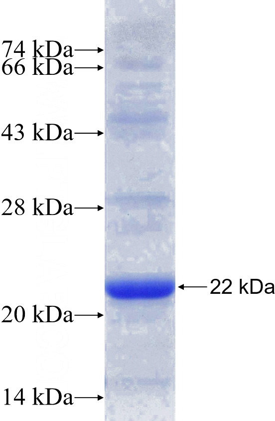 Recombinant Human NFKBIZ SDS-PAGE