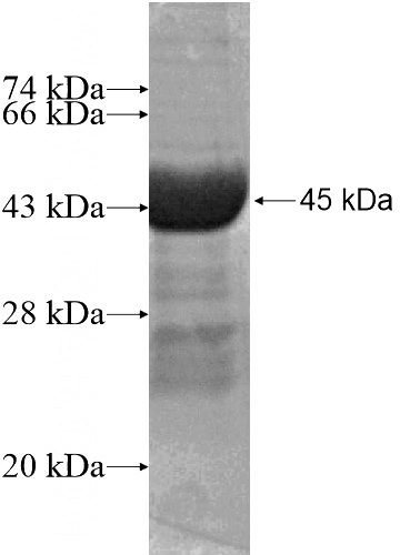 Recombinant Human TXNDC6 SDS-PAGE