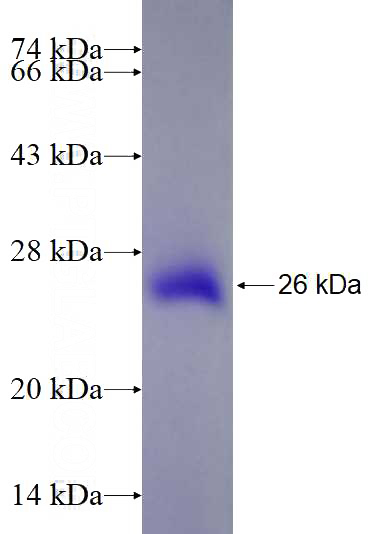 Recombinant Human RNF219 SDS-PAGE