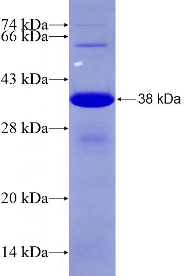 Recombinant Human SGCA SDS-PAGE