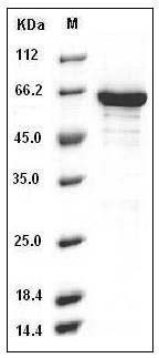 Mouse EphB1 / EPHT2 Protein (His & GST Tag) SDS-PAGE