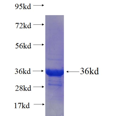 Recombinant human LSM8(Full length) SDS-PAGE