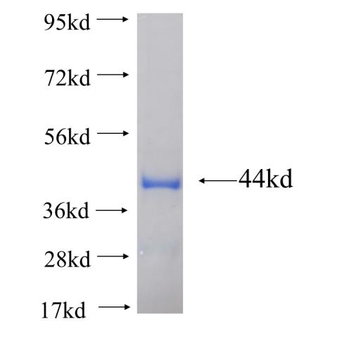 Recombinant human DNTT,TDT SDS-PAGE