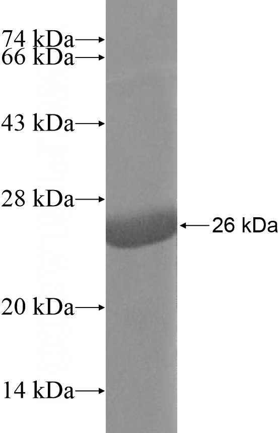 Recombinant Human TXNDC6 SDS-PAGE