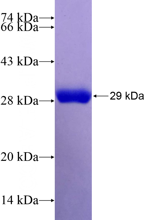 Recombinant Human IFT172 SDS-PAGE