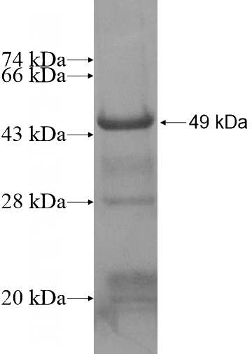Recombinant Human ABHD8 SDS-PAGE