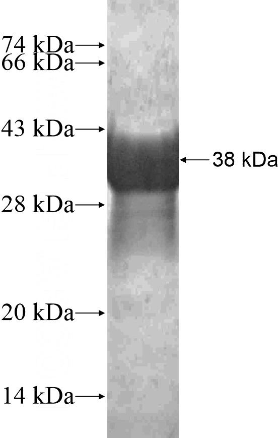 Recombinant Human CLDN23 SDS-PAGE