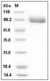 Human EphA4 Protein (His Tag) SDS-PAGE