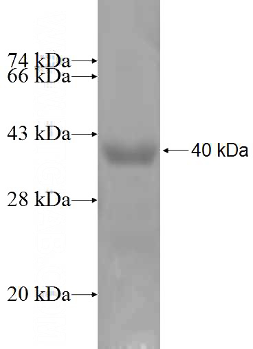 Recombinant Human ZNRD1 SDS-PAGE