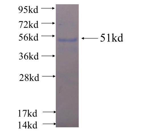 Recombinant human PLEKHO1 SDS-PAGE