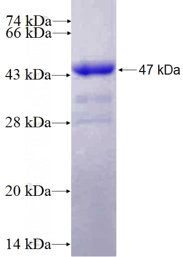 Recombinant Human LZIC SDS-PAGE