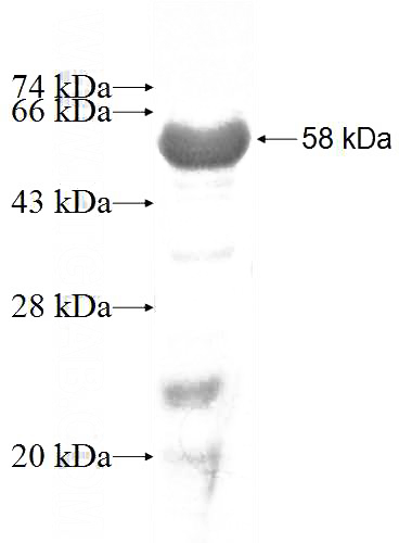 Recombinant Human PALMD SDS-PAGE