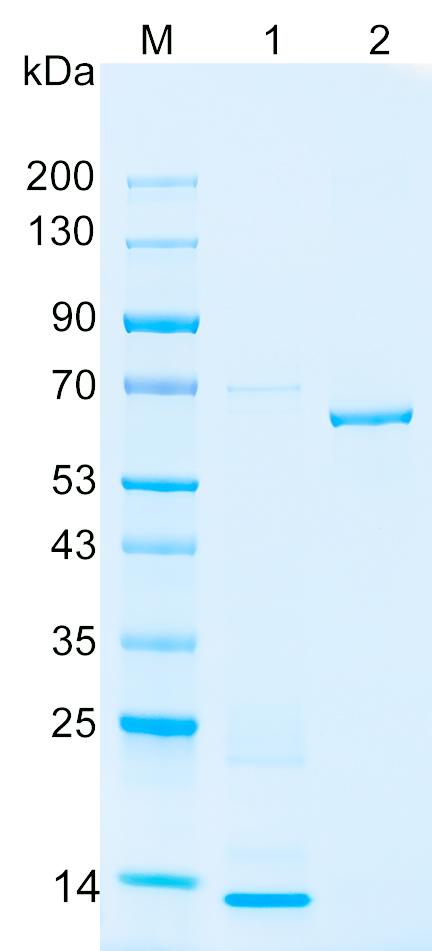 Recombinant RBM20 protein (His tag)