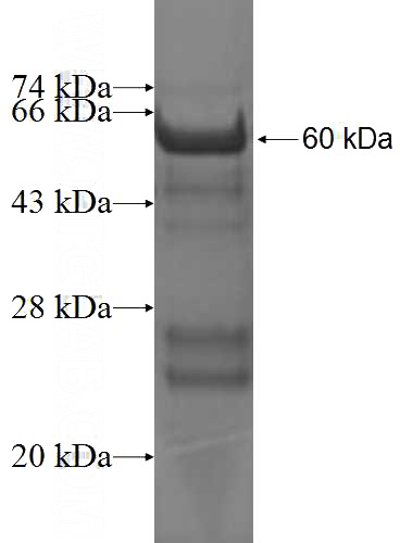 Recombinant Human GIPC2 SDS-PAGE