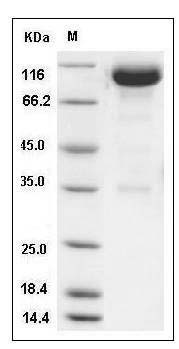 Mouse BCAM Protein (Fc Tag) SDS-PAGE