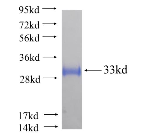 Recombinant human LASS2 SDS-PAGE
