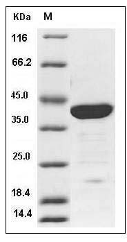 Human Galectin-7 / LGALS7 Protein (GST Tag) SDS-PAGE