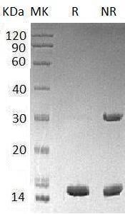 Human LAMTOR3/MAP2K1IP1/MAPKSP1/PRO2783 (His tag) recombinant protein