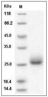 Mouse Ephrin-A4 / EFNA4 Protein (His Tag) SDS-PAGE