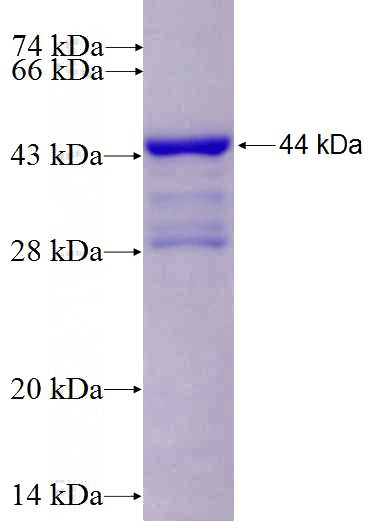 Recombinant Human MYBBP1A SDS-PAGE