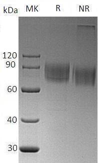 Human CDH3/CDHP (His tag) recombinant protein
