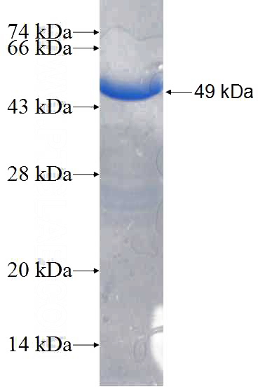 Recombinant Human RRAS SDS-PAGE