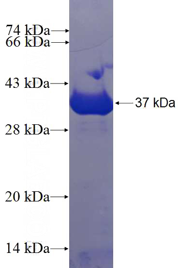 Recombinant Human STX1B SDS-PAGE