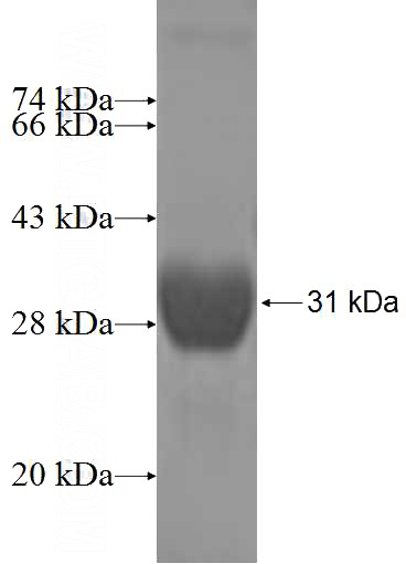 Recombinant Human ALDH3B1 SDS-PAGE
