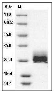 Mouse Ephrin-A1 / EFNA1 Protein (His Tag) SDS-PAGE